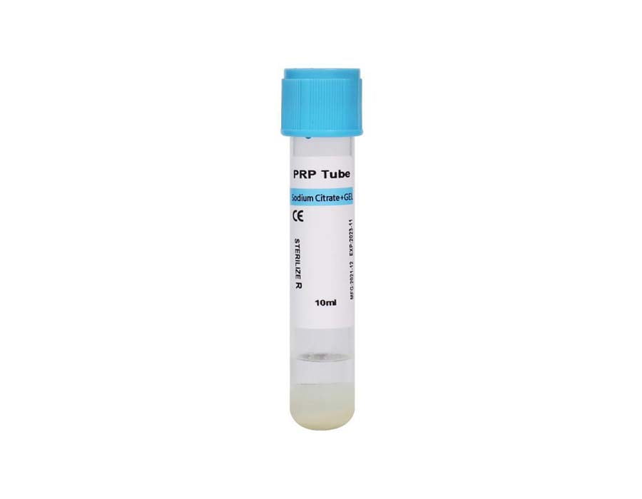 PRP Treatment 2 PRP Treatment 2